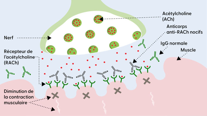 The neuromuscular junction without MG